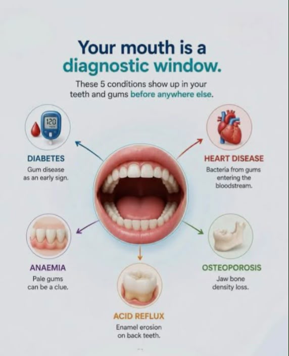 Infographic showing five systemic health conditions that can be detected through oral symptoms