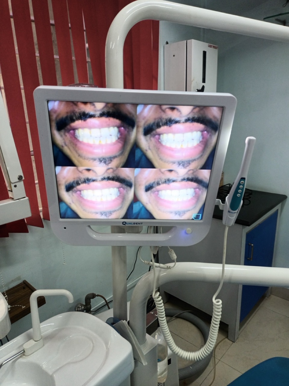 Intraoral camera used for dental imaging